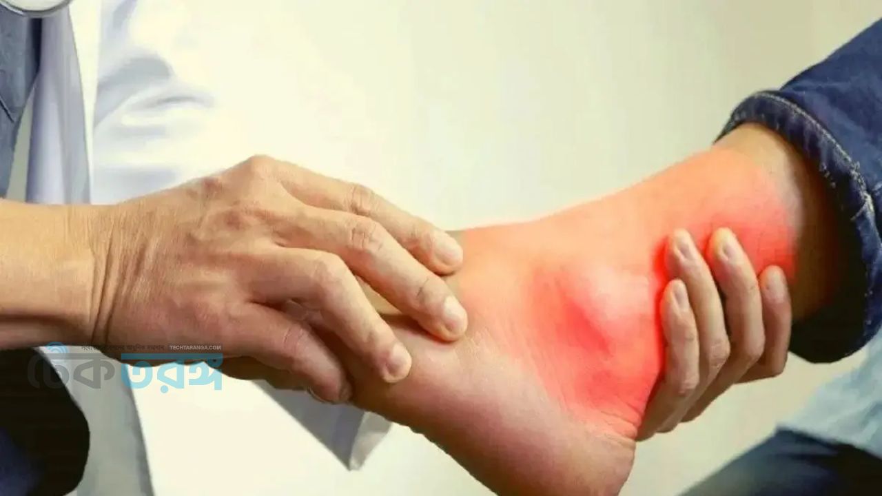 লাল মাংস আর ডাল জাতীয় খাবার খেলে ইউরিক অ্যাসিড বাড়ে?