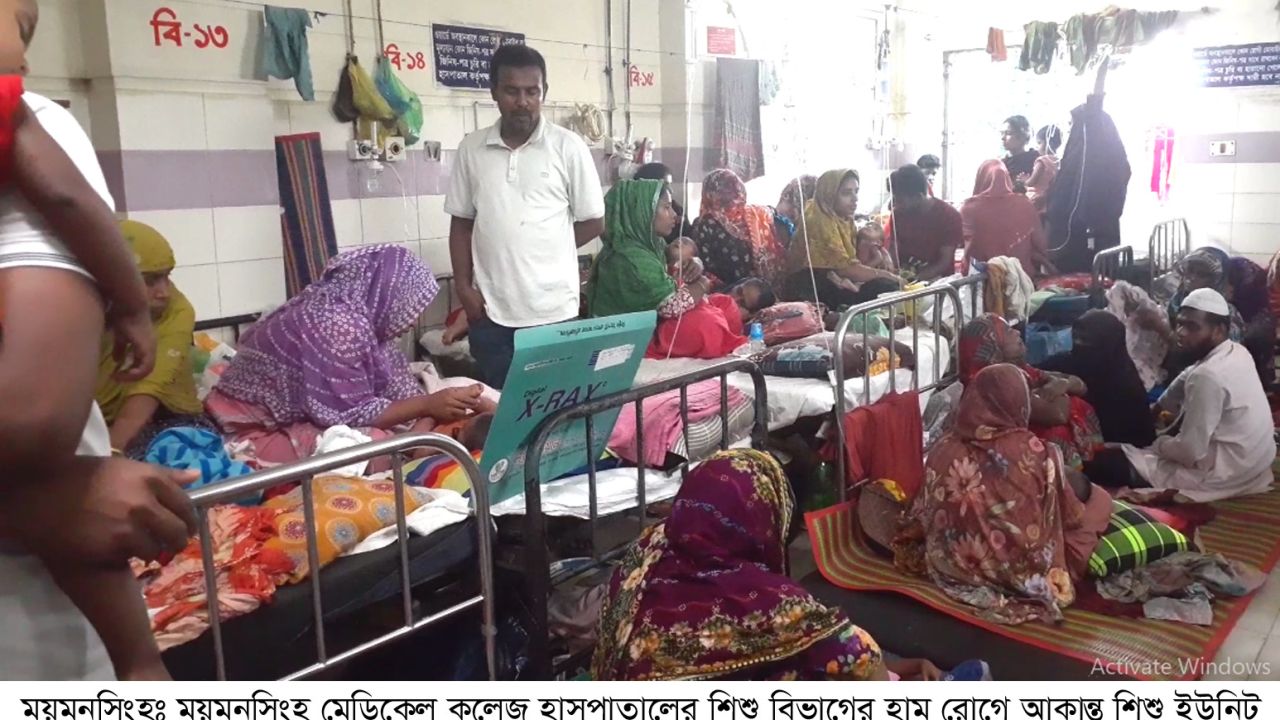 সারাদেশে শিশুদের হামের প্রকোপ