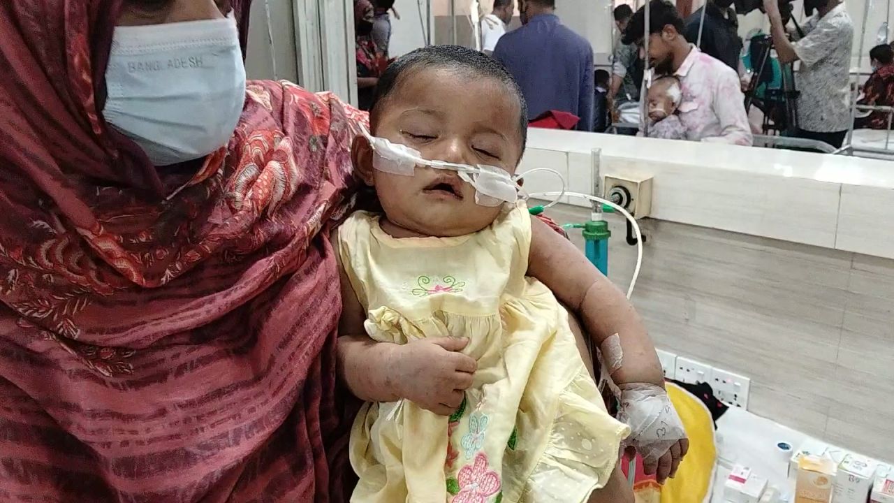দেশে হামের ভয়াবহ প্রাদুর্ভাব: একদিনে ৪ শিশুর মৃত্যু