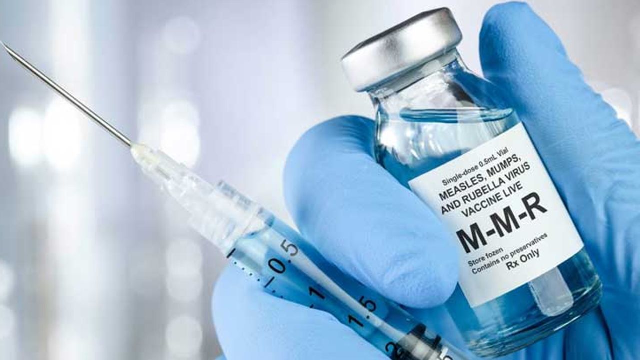 ৩০ উপজেলায় হামের বিশেষ টিকাদান কর্মসূচি শুরু