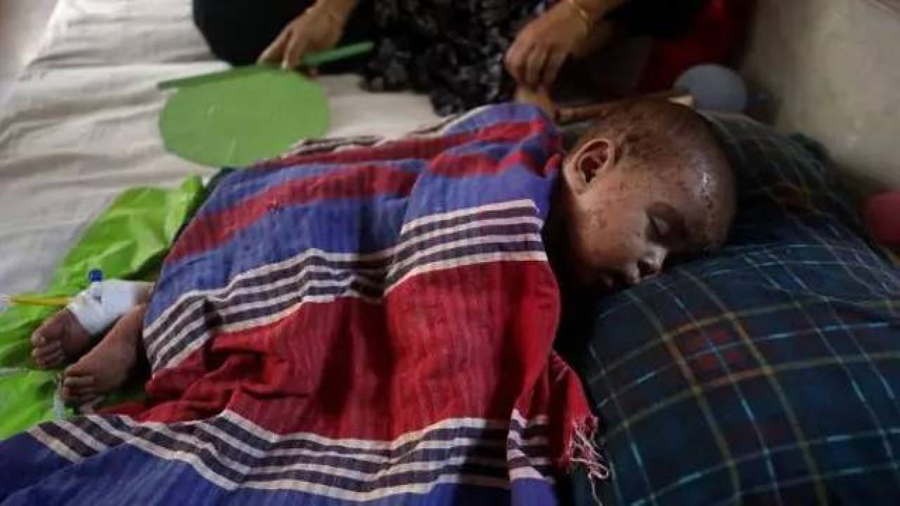 হাম পরিস্থিতি: ঝুঁকিপূর্ণ এলাকাগুলো, সমস্যা ও সমন্বিত উদ্যোগ  