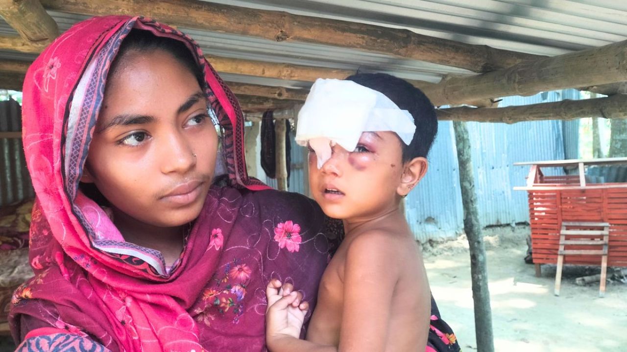 মহেশপুরে কুকুরের কামড়ে শিশুর চোখ-মুখ ক্ষতবিক্ষত