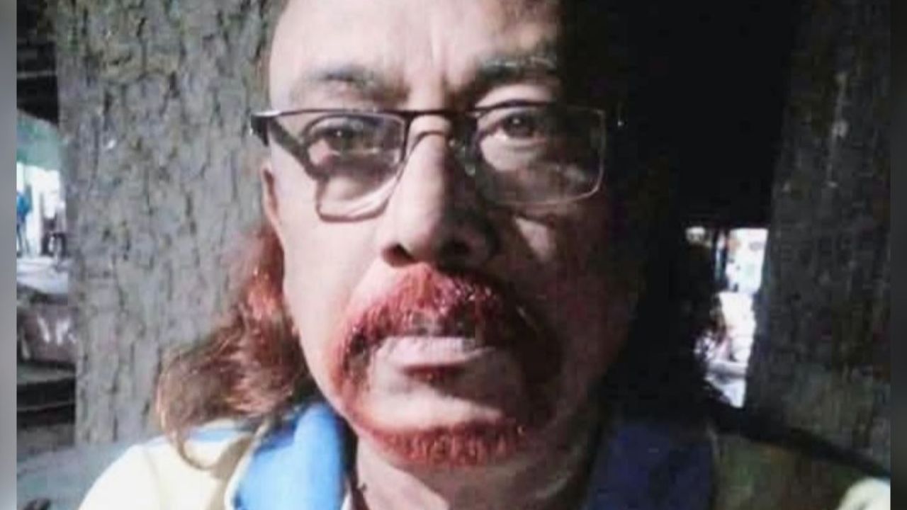 জামালপুরে দুদকের মামলায় কারাবন্দী আ.লীগ নেতার মৃত্যু