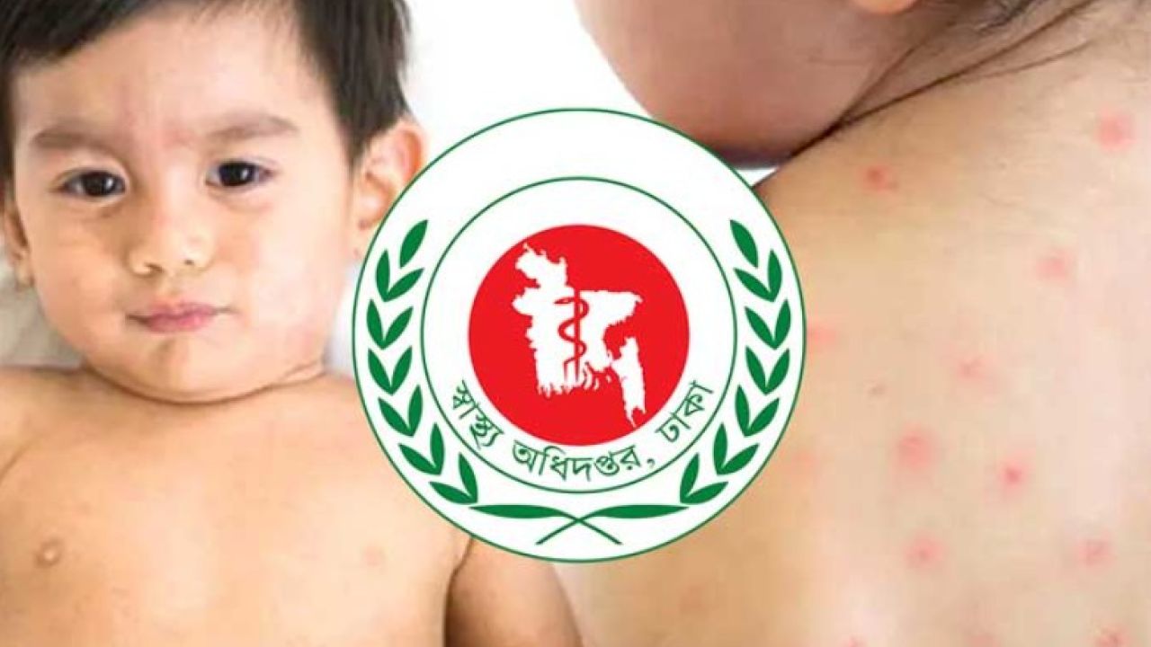 হামের উচ্চ ঝুঁকিতে বাংলাদেশ, উদ্বেগ বিশ্ব স্বাস্থ্য সংস্থার