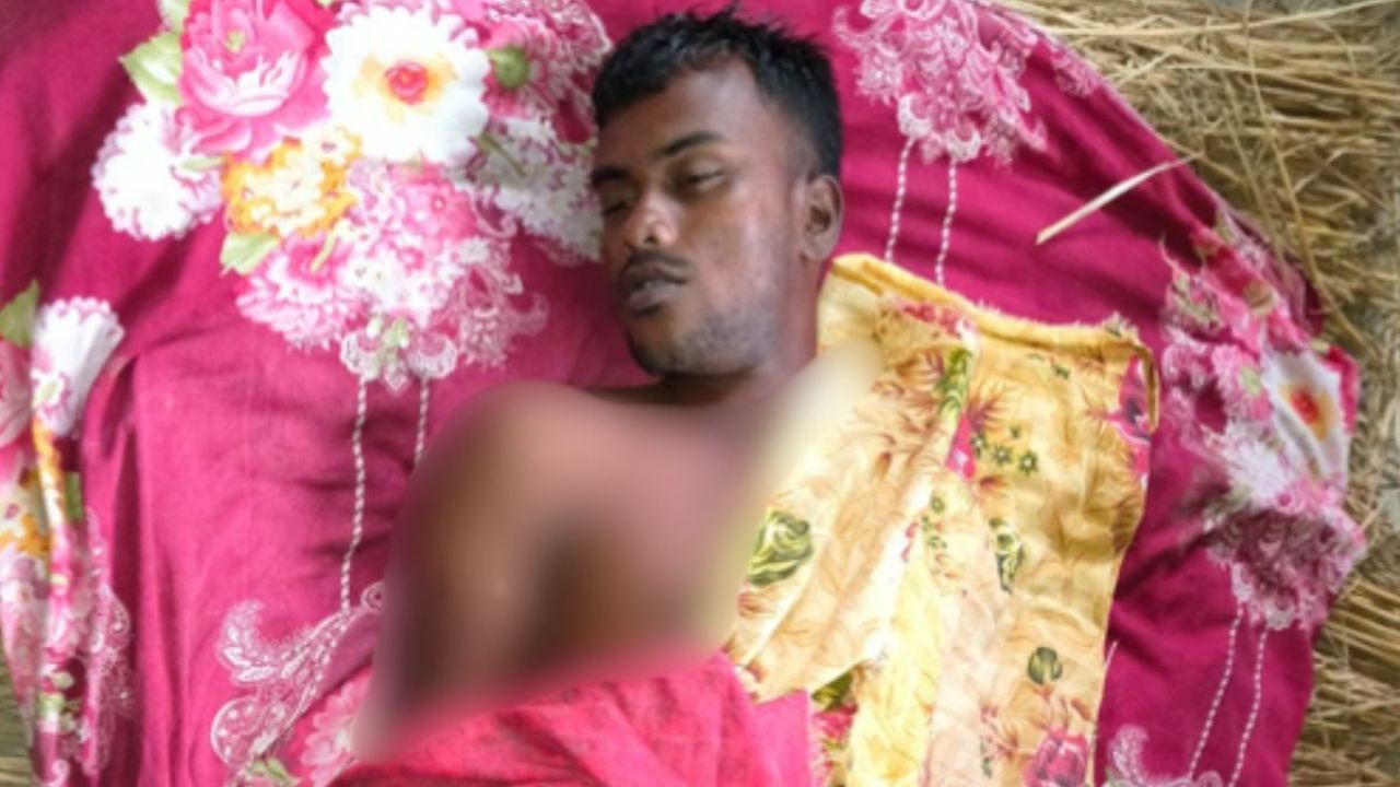 বজ্রপাতে চা-শ্রমিকের মৃত্যু, আহত ২