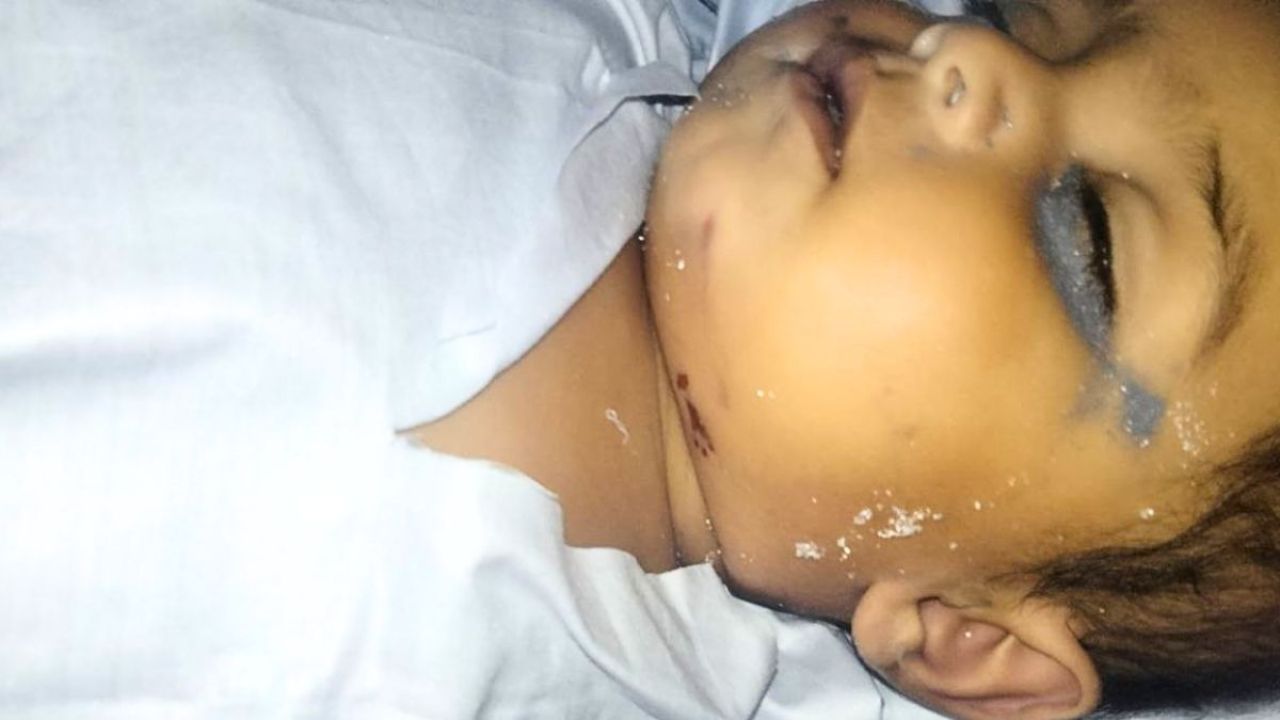বোয়ালমারীতে বাঁশের মাচা থেকে পড়ে প্রাণ হারাল শিশু