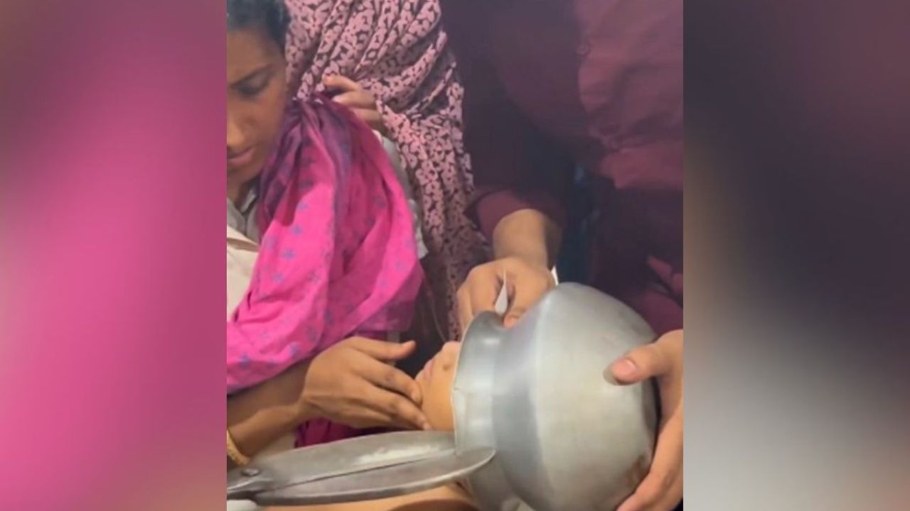 শিশুর মাথায় আটকে গেল পাতিল, কেটে উদ্ধার