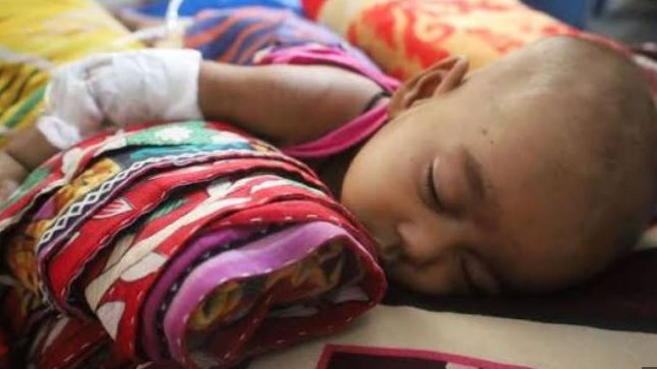 হাম ও উপসর্গে প্রাণহানি বেড়ে ৭১৯
