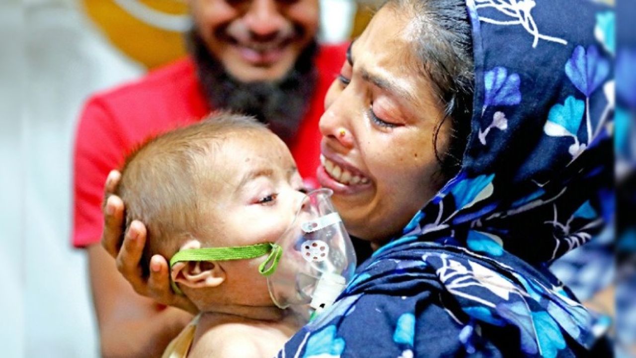 হাম উপসর্গে ঝরলো আরও ৪ প্রাণ, সিলেটে ৩