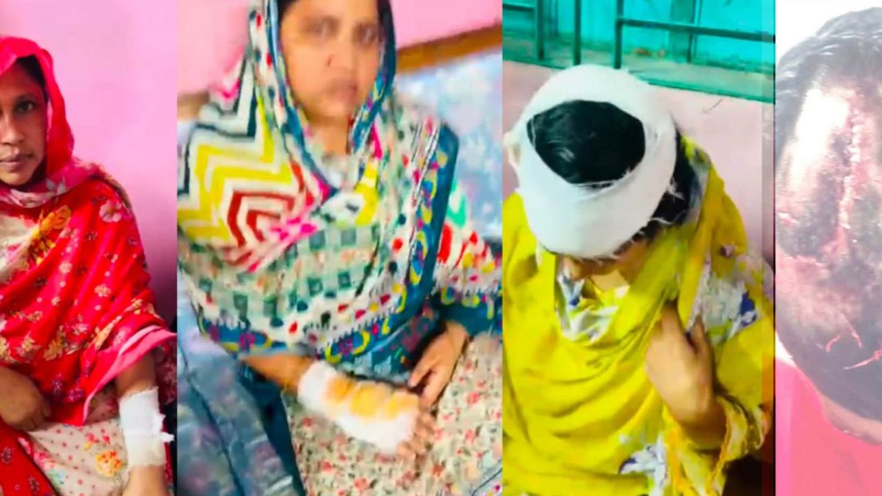 জমি নিয়ে বিবাদে আক্রান্ত এক পরিবারের আহাজারি
