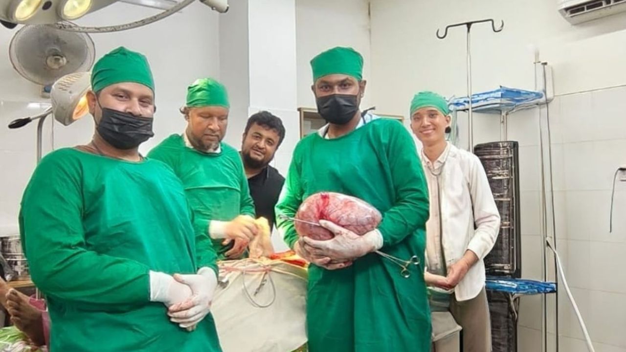 নারীর পেট থেকে ফুটবল আকৃতির টিউমার অপসারণ