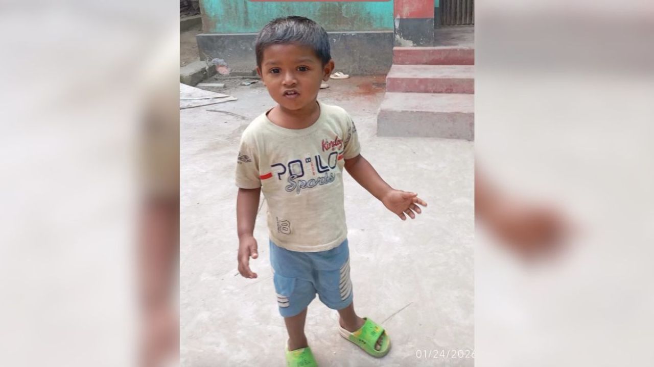 মশার কয়েলের আগুনে দগ্ধ শিশু রাসিনকে বাঁচানো গেল না