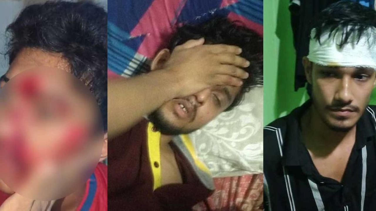 কাপ্তাই পলিটেকনিকে সংঘর্ষে রক্তাক্ত ৯