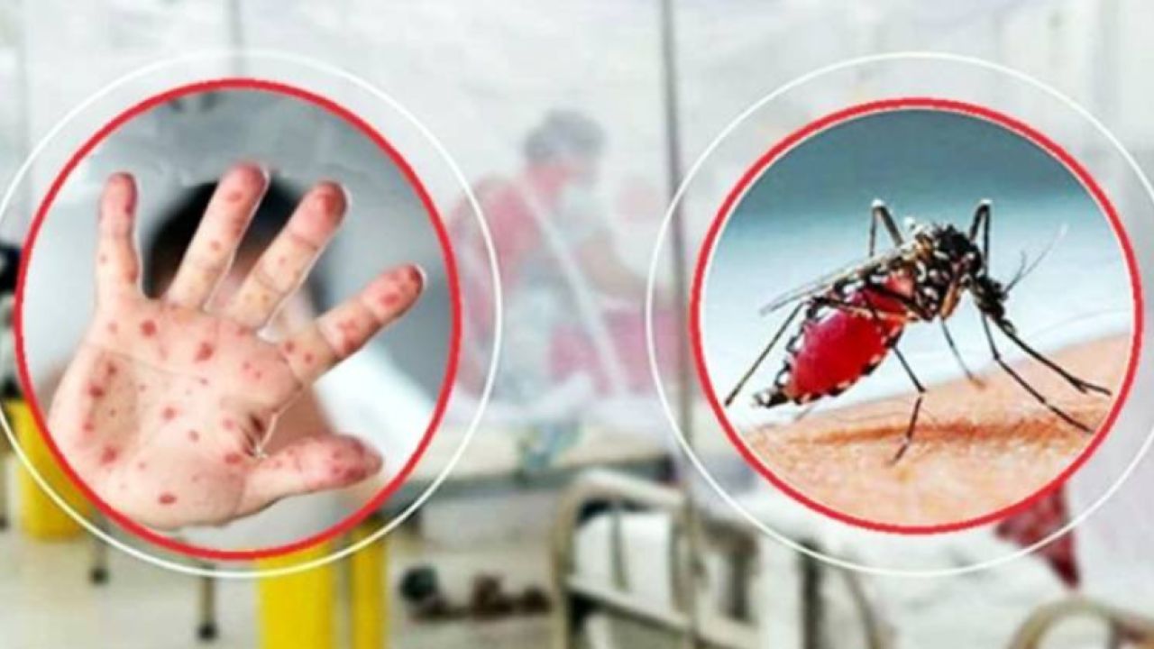 হাম-ডেঙ্গুতে মৃত্যু ১০৯৭, ডিসেম্বরে আরও শঙ্কা