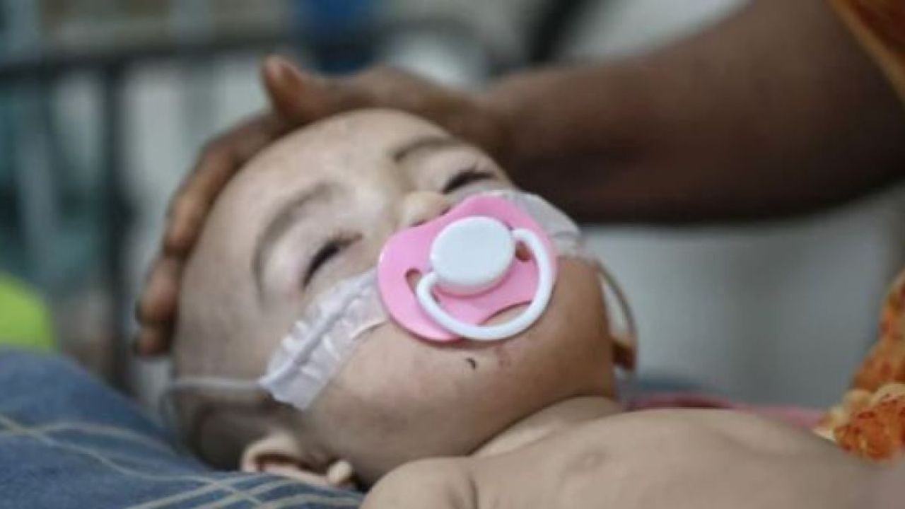 ২৪ ঘণ্টায় হামের উপসর্গ নিয়ে ৯ জনের মৃত্যু