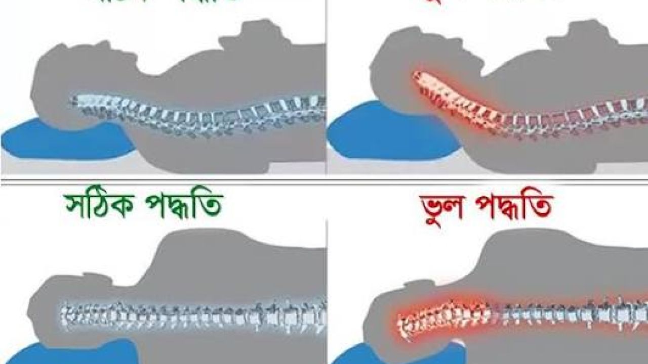 ঘাড়ের ব্যথার সঙ্গে বালিশের সম্পর্ক কতটা