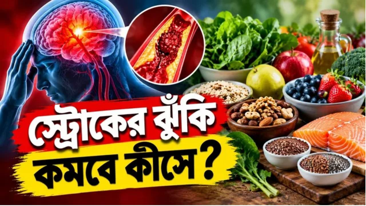 স্ট্রোকের ঝুঁকি কমাতে খাদ্যতালিকায় রাখতে পারেন যেসব খাবার